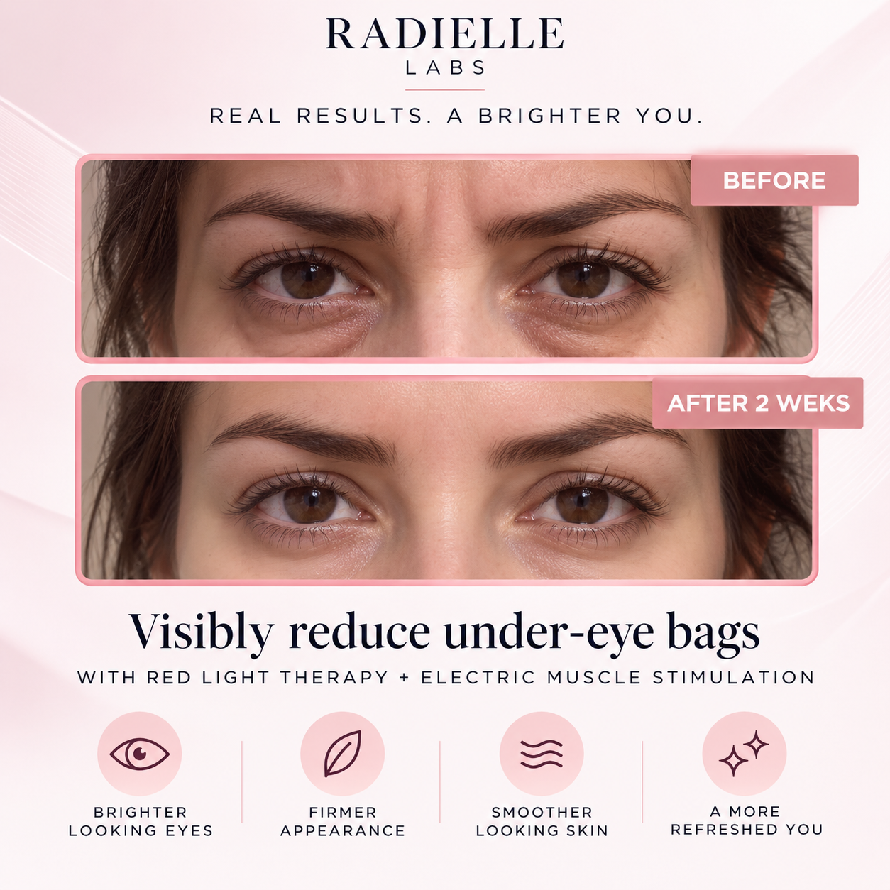 2-in-1 Red Light Therapy + EMS To Erase Eye Bags